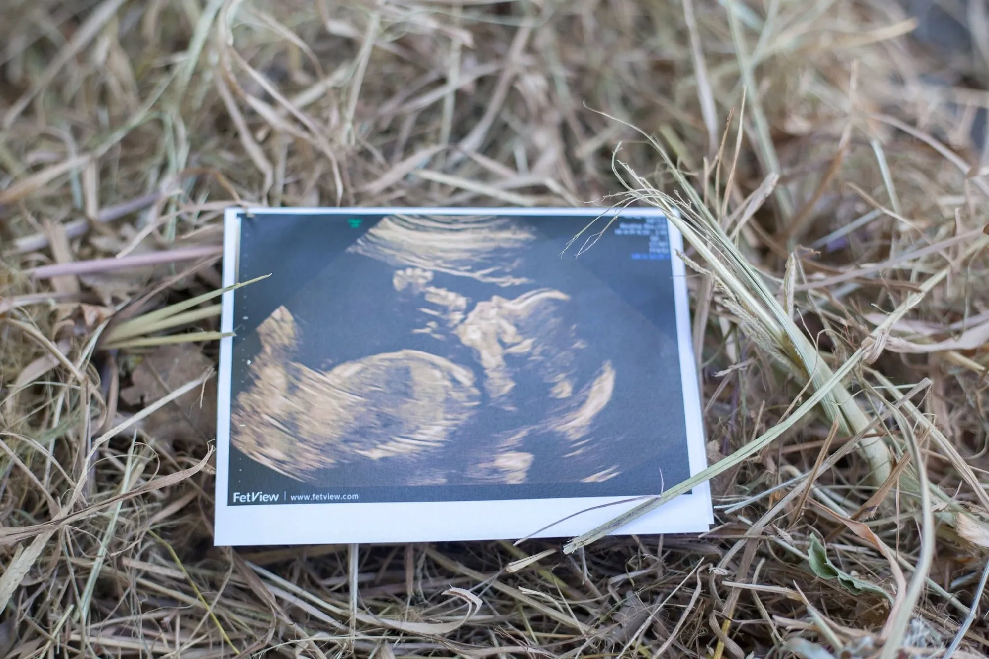 A baby's ultrasound scan print lying in a nest of dry grass.